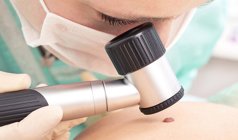 Dermatologist consultation