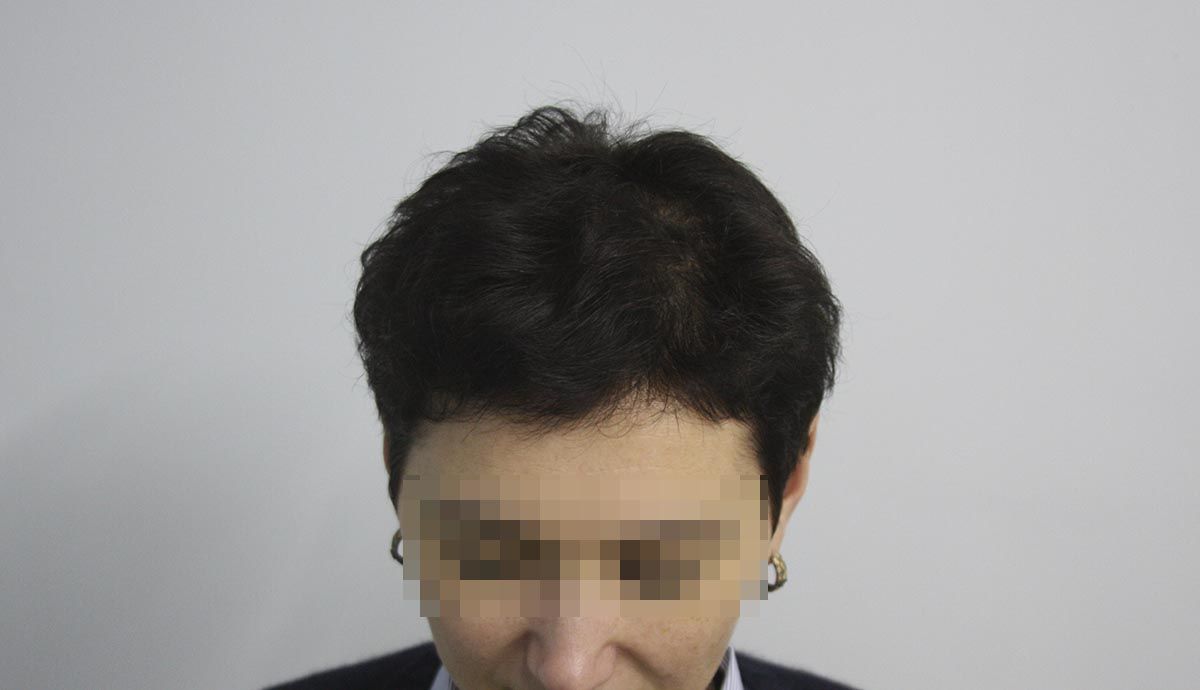 После