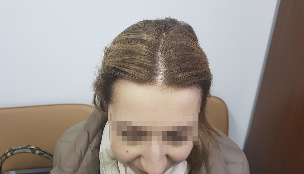 До