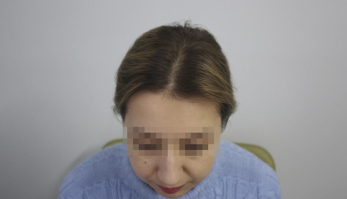После