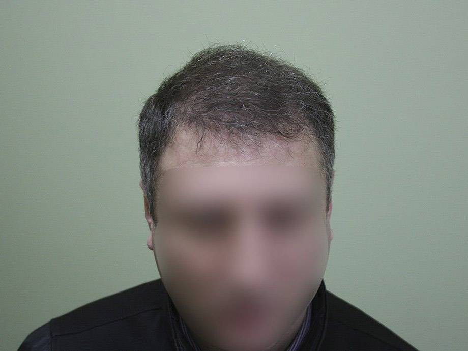 После