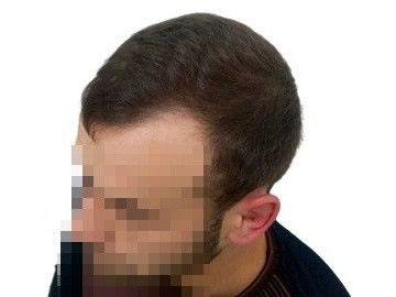 До