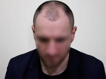 До