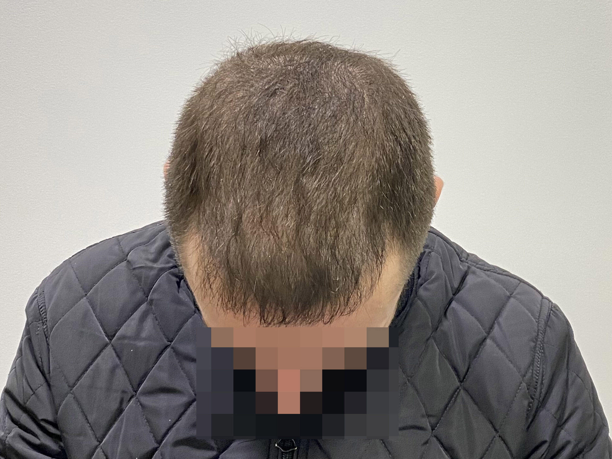 После
