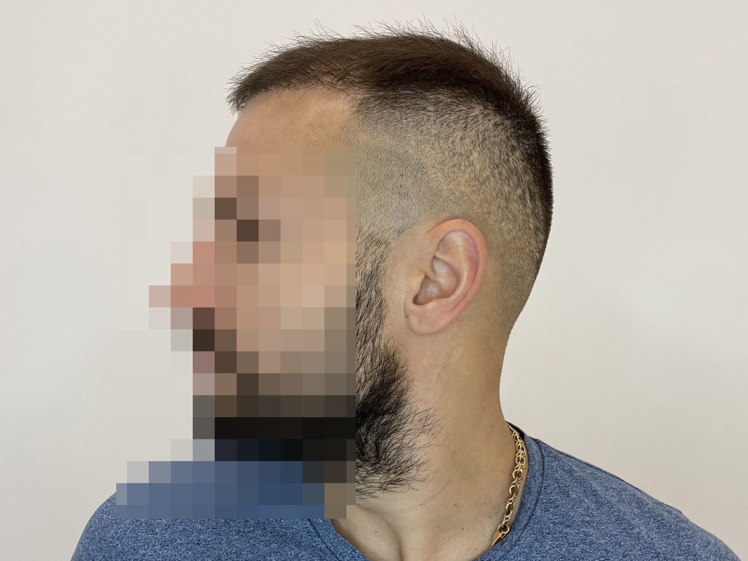 До