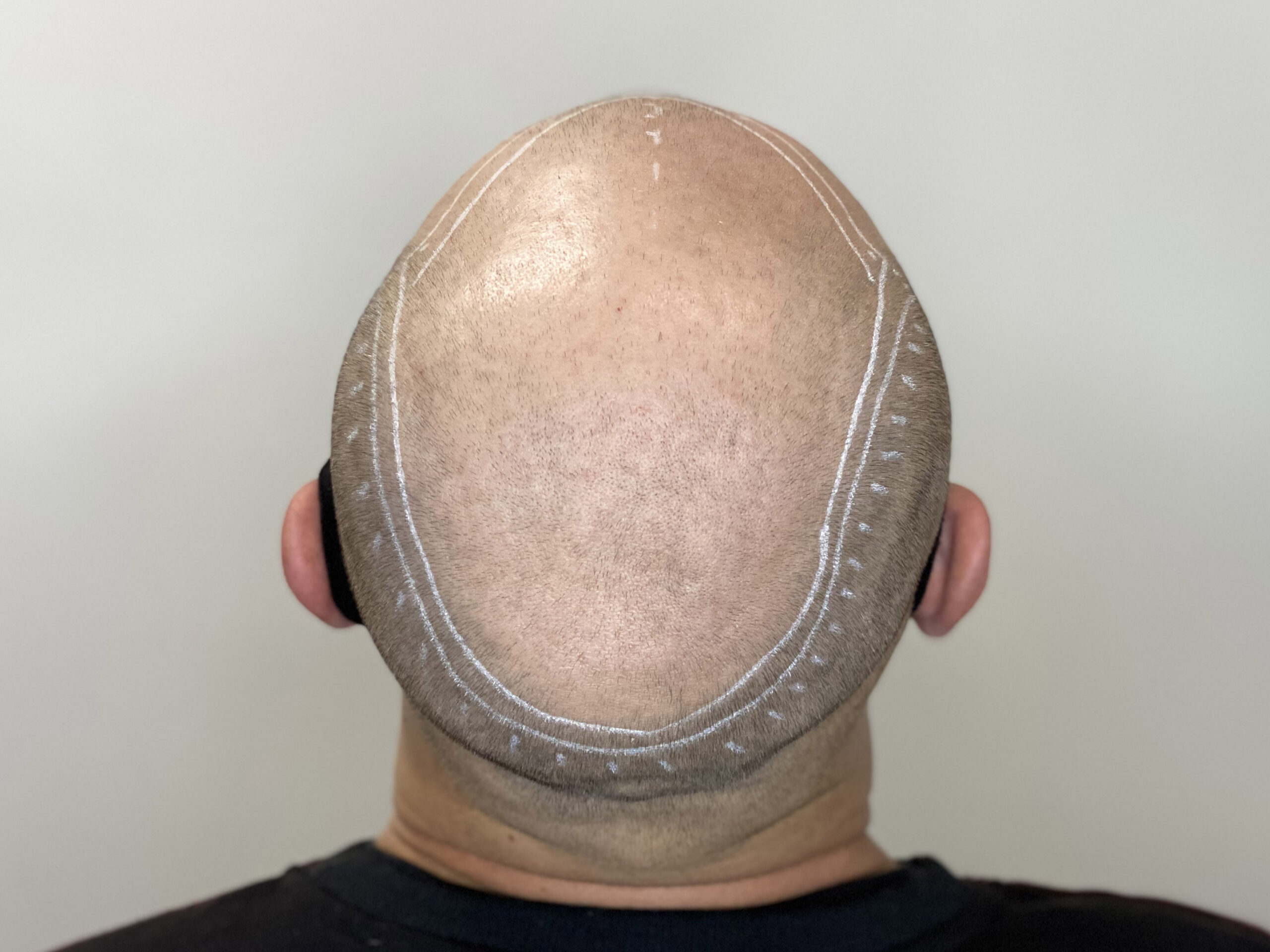 До