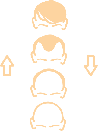 Transplantation