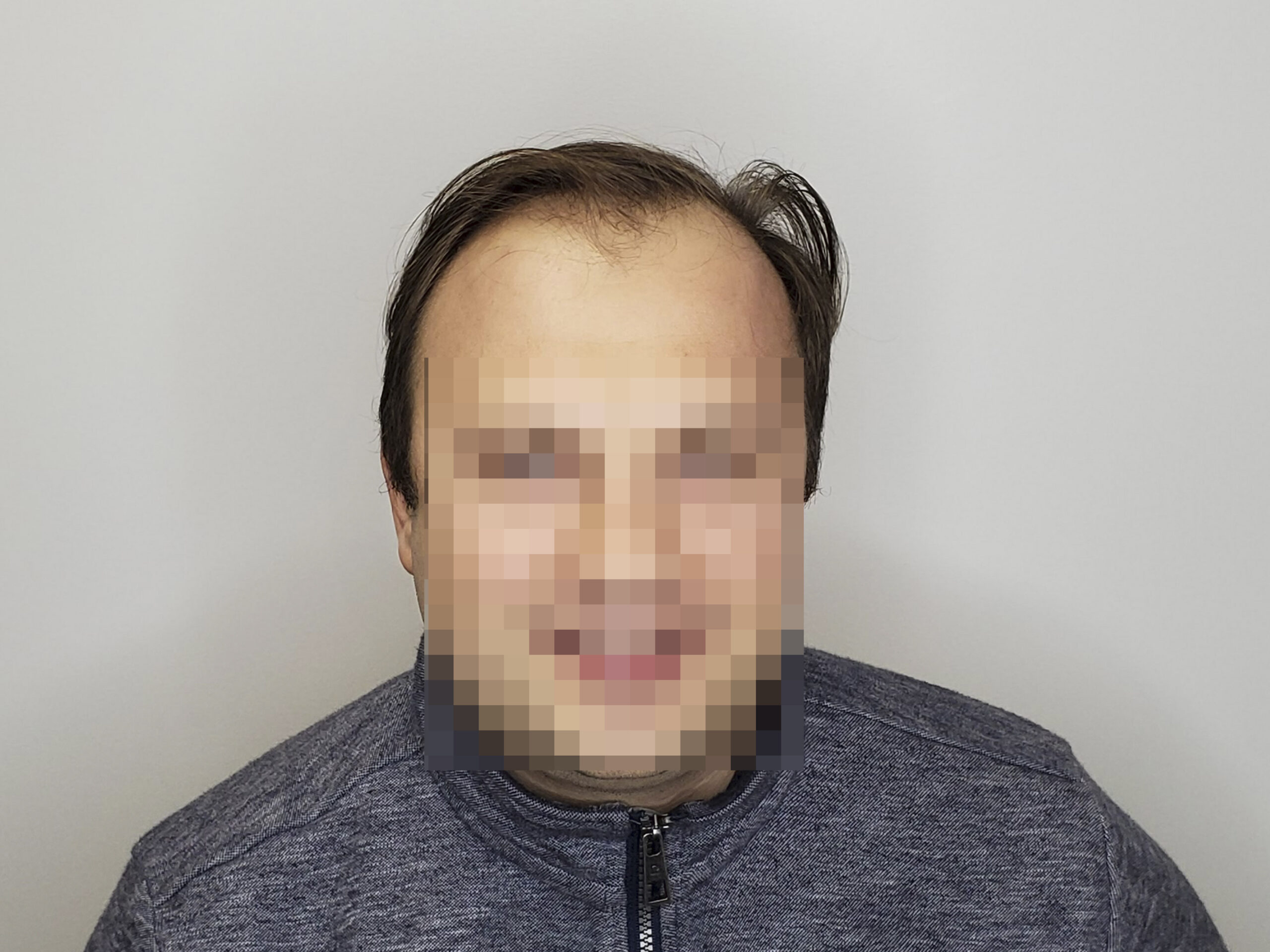 До