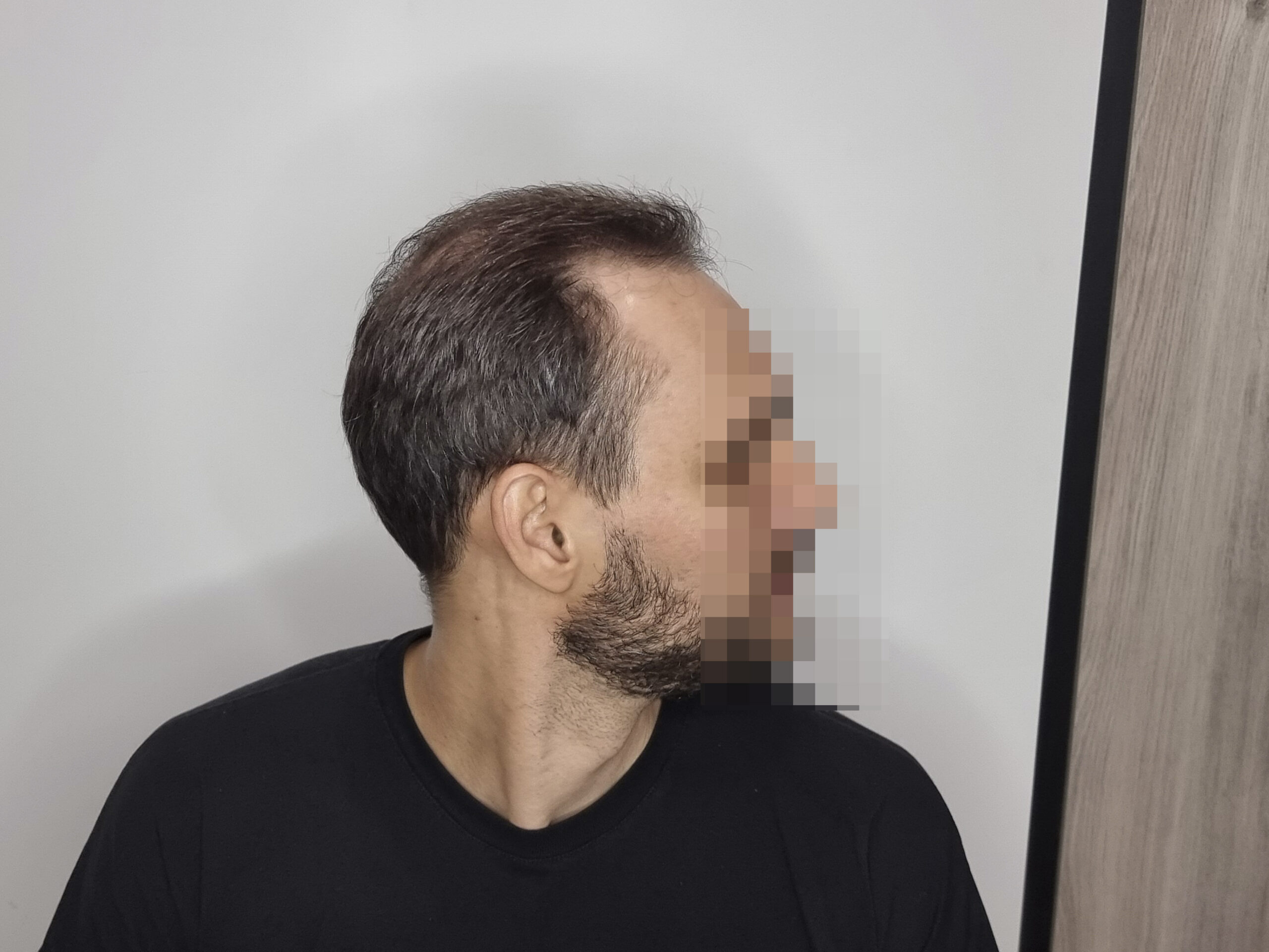 До