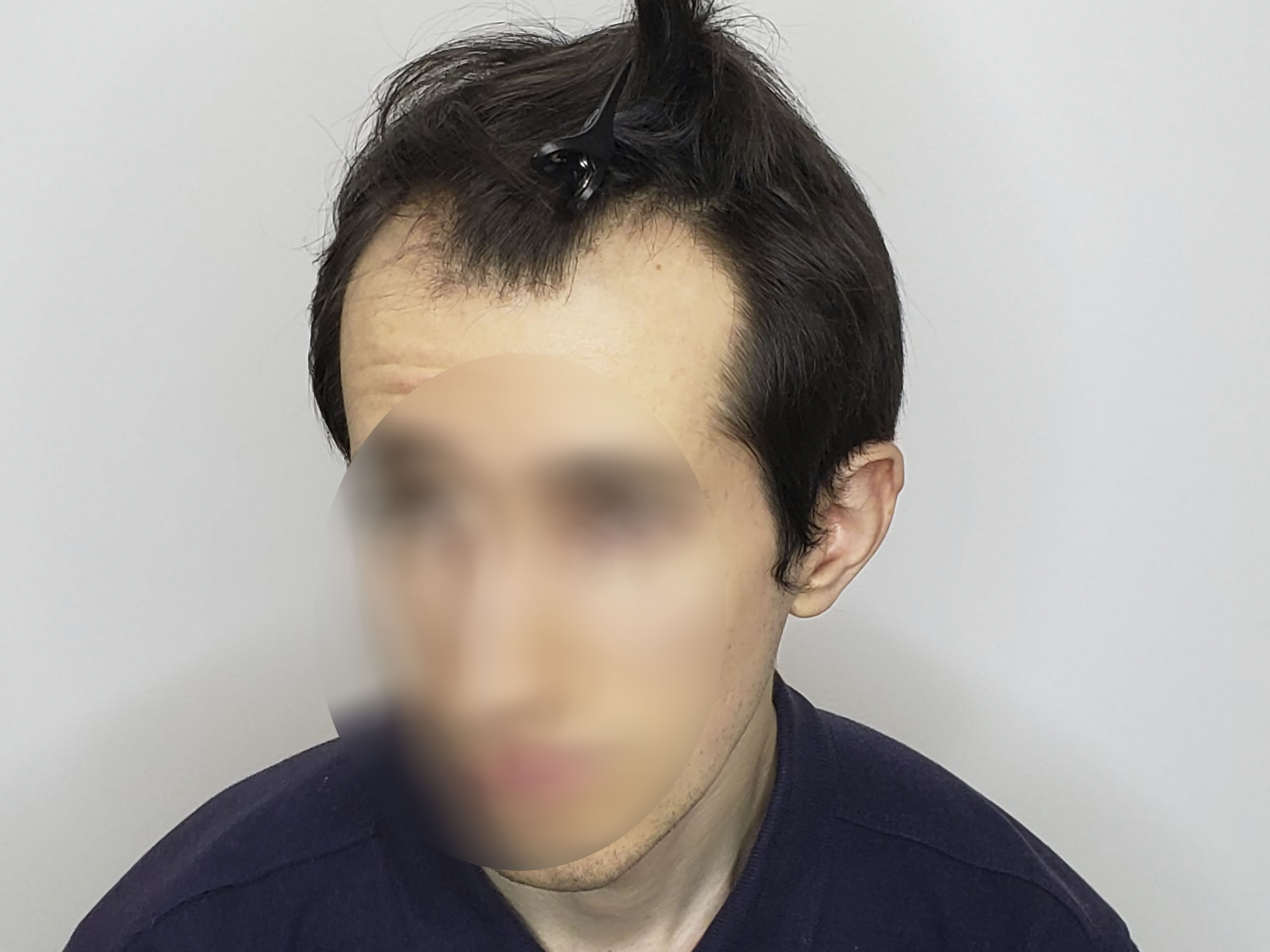 До