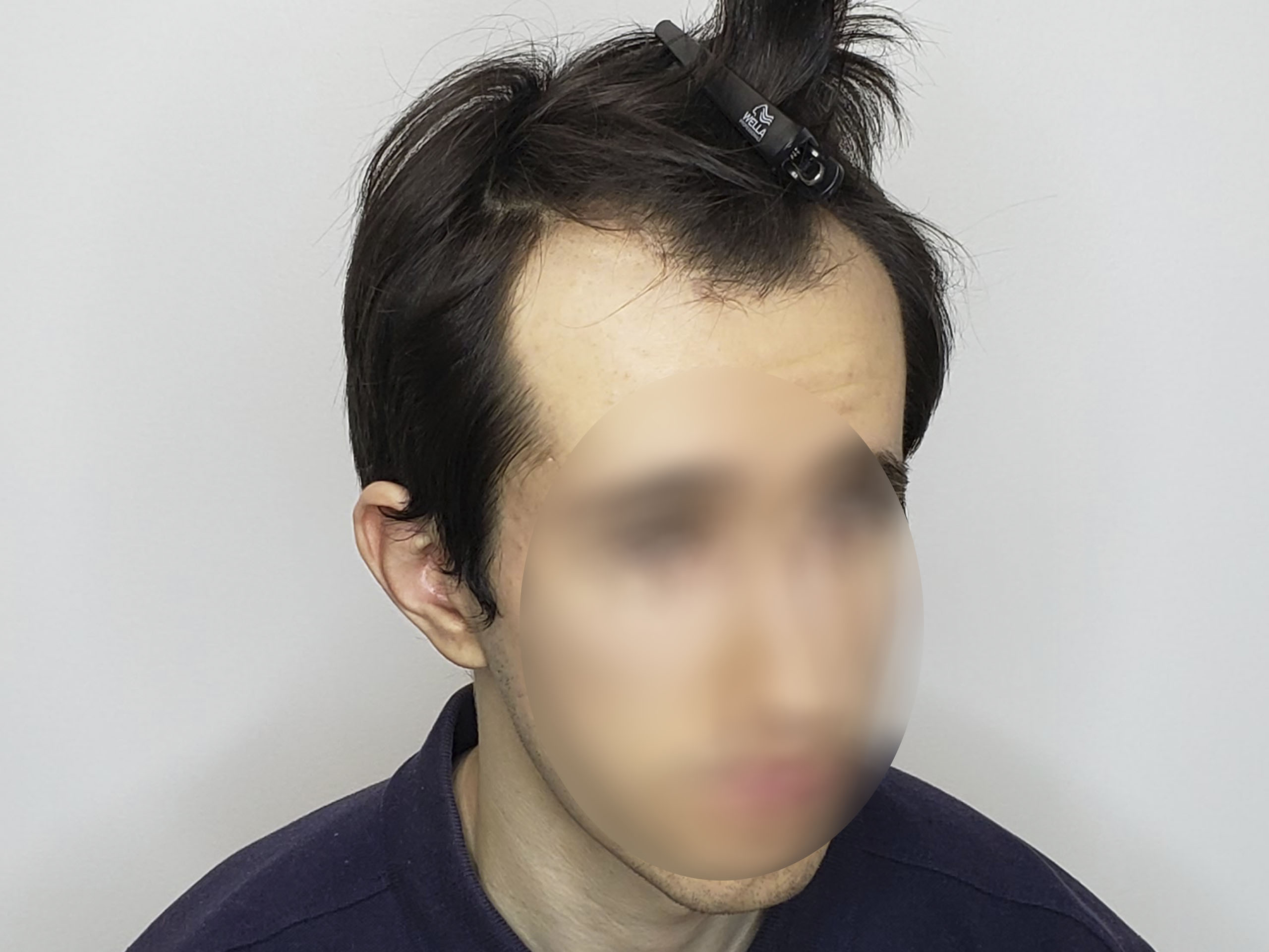 До