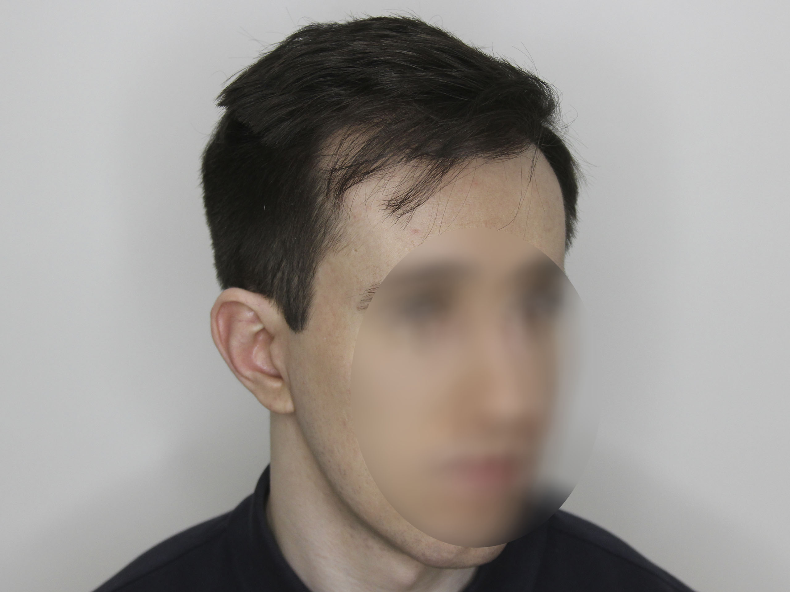 После